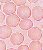 LBA血液細胞分析（1時間後）