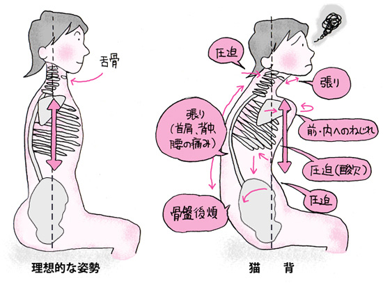 腰椎・背骨・骨盤を補正するとどうなる？