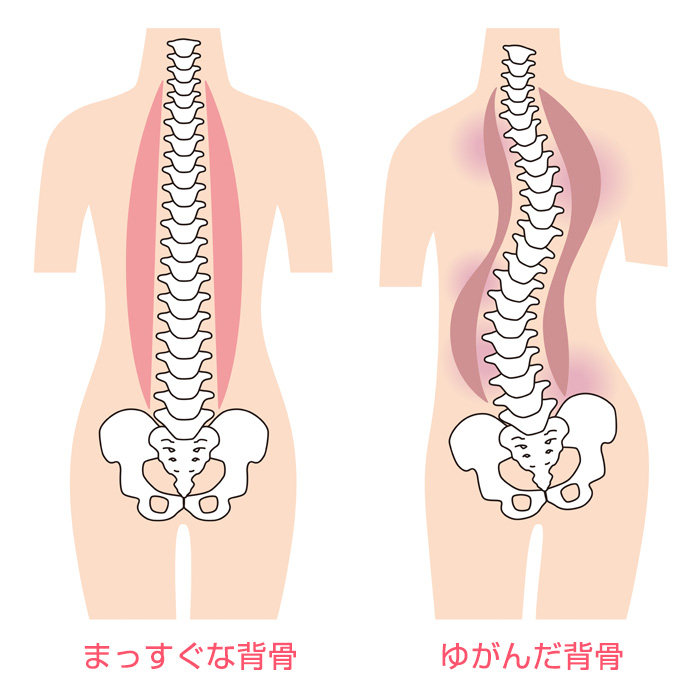 背骨