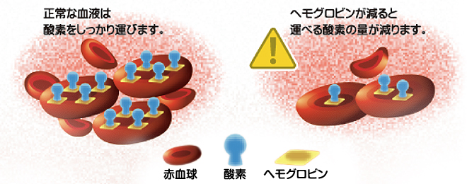 正常な血液は酸素をしっかり運びます。ヘモグロビンが減ると運べる酸素の量が減ります。