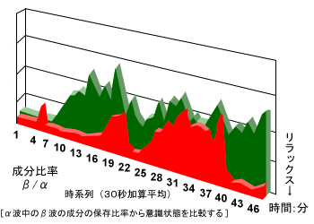 脳波測定