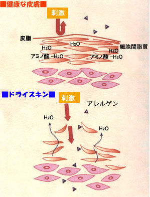 健康な皮膚とドライスキンの肌構造