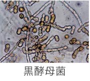 黒酵母菌