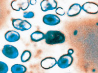 酵母菌の画像