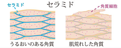 セラミド