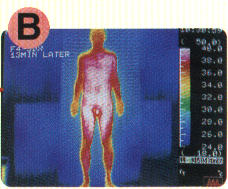 ▲スマーティ使用後の人体の温度分布図。体のすみずみまで充分に温熱されます。